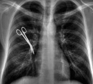Radiiografía de la ausencia de comillas.